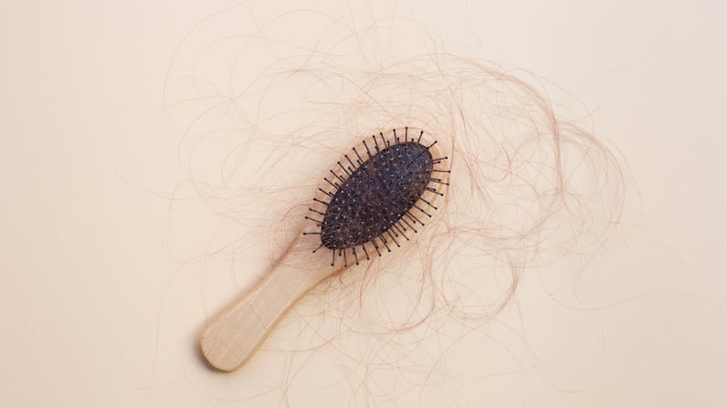 caida cabello-1