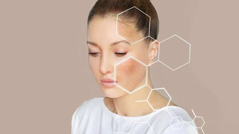 piel seca invierno-1